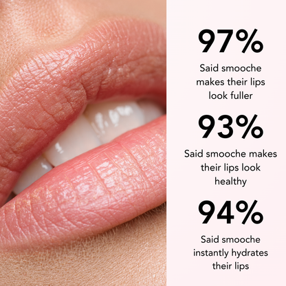 Smooche Prachtige Lippen Plumper